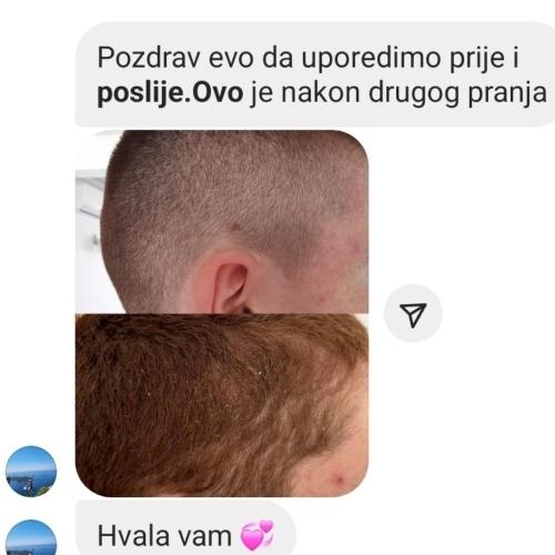 image(38) â kopija